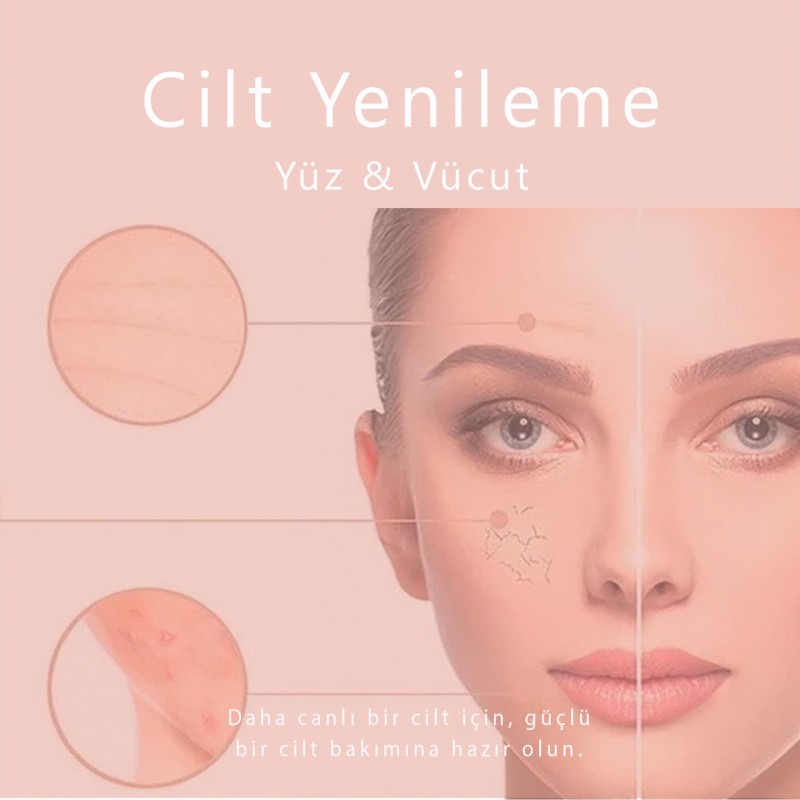 Cilt Yenileme