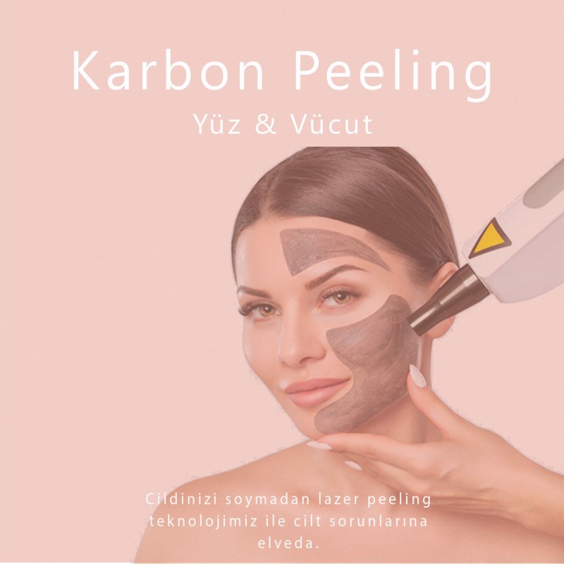 Karbon Peeling